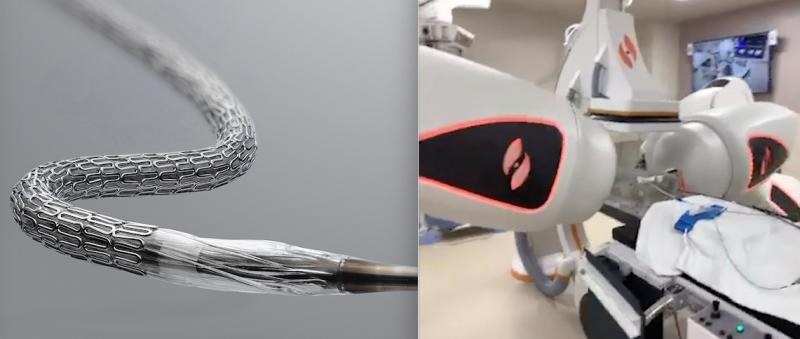 Two of the top preforming pieces of content in October was the FDA clearance for the first indication for shortened DAPT for Medtronic's Resolute Onyx Drug Eluting Stent. A virtual tour of the new robotic electrophysiology lab at Banner Health led by Pete Weiss, M.D., also was among the most popular cardiology technology content.