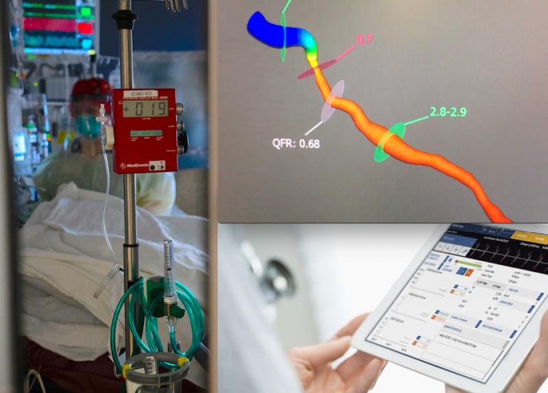 The most popular videos in 2021 included the use of ECMO for COVID-19 patients, a demonstration of the Medis QFR angiography image derived FFR system, and the use of remote EP monitoring systems.