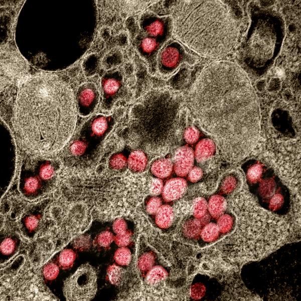 This is one of the images from the NIH photo gallery of COVID-19 images it has captured as part of its research on the virus. The full gallery can be found at https://www.flickr.com/photos/nihgov/albums/72157713108522106/with/49807561242/. #COVID19 #SARScov2