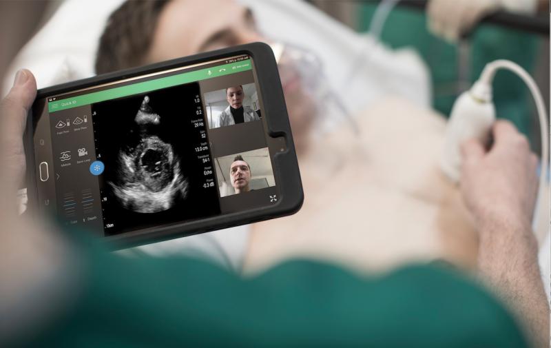 The Philips Lumify point-of-care ultrasound (POCUS) system uses an app and a transducer to convert a smartphone into a portable ultrasound system. Philips and GE Healthcare both offer small hand-held systems and are now facing increased competition from new POCUS vendors like Butterfly Network. 