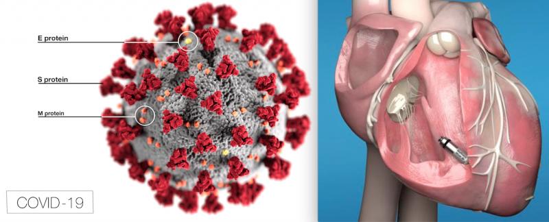 Coronavirus (COVID-19) and the FDA clearance of the Micra AV, the world’s smallest pacemaker with atrioventricular (AV) synchrony, topped the news analytics in February 2020 on DAIC magazine. COVID-19 virus image courtesy of CDC.
