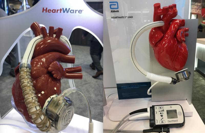 The Medtronic Heartware and Abbott Heartmate 3 LVADs and others currently cleared by the FDA might be easier to use in Medicare advanced heart failure patients under new guidelines proposed by CMS. Photo by Dave Fornell