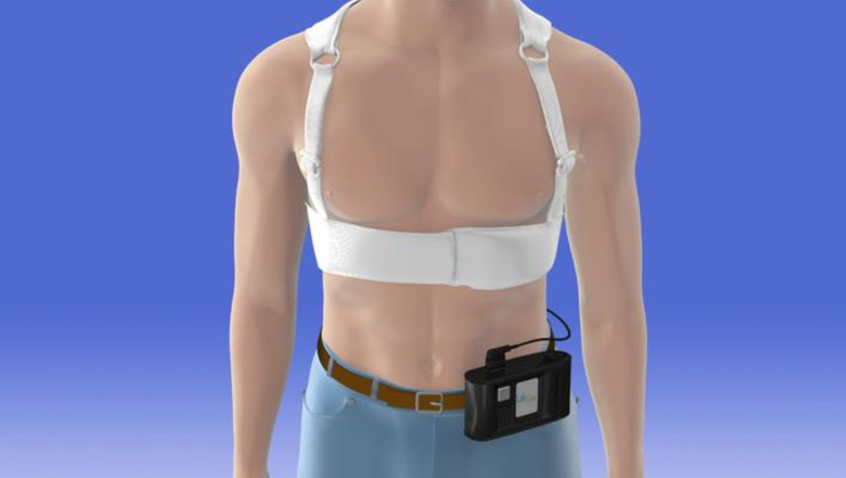 wearable defibrillators prevent sudden cardiac death in pediatric patients