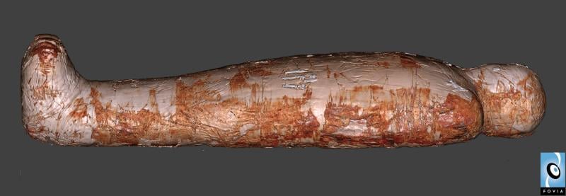3-D reconstruction of a CT scan of a mummy. 
