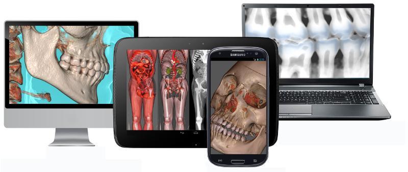 Advanced visualization, RSNA 2014, Remote viewing systems, mobile devices