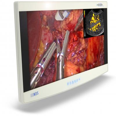 Radiance Ultra, NDS Surgical Imaging, flat panel displays, hybrid OR