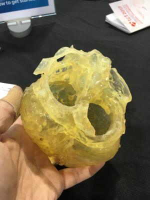 The use of 3-D printed hearts from patients' pre-TAVR planning CT scans have improved outcomes of procedures at the University of Minnesota. Clearly identifying where calcium is located on the valves prior to TAVR device implantation has helped reduce the incidence of paravalvular leak.  #SCAI, #SCAI2018