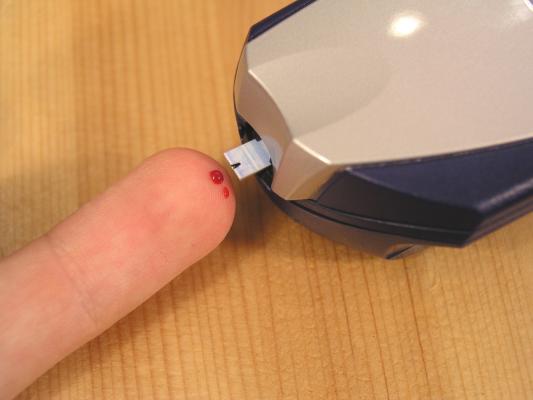 UK Blood Clots Teststing Wafarin Self Monitoring
