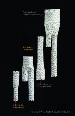 Gore Excluder AAA Stent Graft
