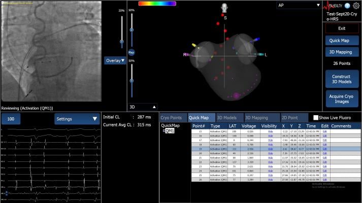 APN Health Releases Navik 3D Cardiac Mapping System