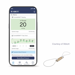 FDA Approves New Capabilities for Abbott's CardioMEMS HF System 