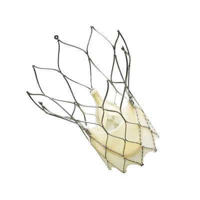 Portico Transcatheter Aortic Valve Successfully Reduces Severe Aortic Stenosis at One Year