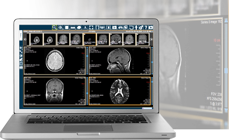 merge iconnect access 5.0 rsna 2013 remote viewing system