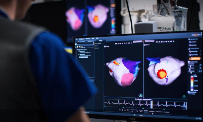 The U.S. Food and Drug Administration (FDA) cleared the Acutus Medical SuperMap, an addition to its AcQMap 3-D imaging and mapping system used to guide electrophysiology (EP) catheter ablation procedures. Adding the SuperMap mode to the AcQMap system enables users to visualize any atrial rhythm in less than three minutes. Rapidly mapping and re-mapping the whole heart chamber facilitates a new procedural workflow in EP ablation, making it practical to execute an iterative "map, ablate, re-map" approach.