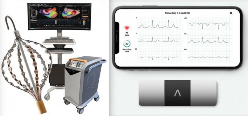 The AcQMap 3D Imaging and Mapping System, left, and the AliveCor KardiaMobile device and app for personal ECG monitoring using a smartphone, right. The companies plan to use remote monitoring to see if it helps improve care for ablation patients.