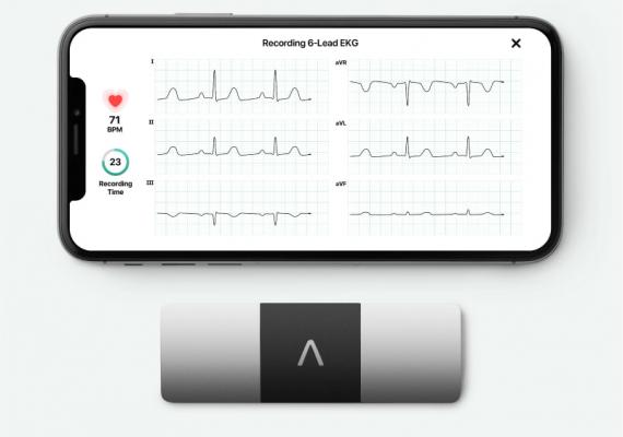 AliveCor's KardiaMobile six-lead ECG system that works on smartphone platforms. It was cleared in 2019 and includes artificial intelligence algorithms to help identify arrhythmias. 