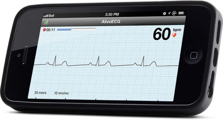 AliveCor AliveECG App Heart Monitor ECG Wireless Remote Access Mobile Device