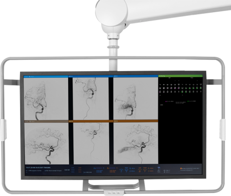 AngioFlow by RapidAI will facilitate confident clinical decision-making immediately prior to or after neuro-interventional procedures