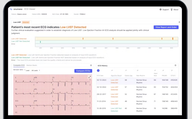 Artificial intelligence (AI)-driven health technology company, Anumana, which developed the FDA-approved ECG-AI LEF algorithm, has announced its receipt of the International Organization for Standardization (ISO) 13485 certification for its Quality Management System.