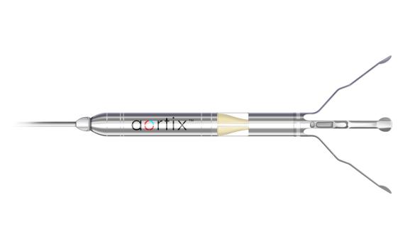 The Aortix intra-aortic axial flow pump offers hemodynamic support to relieve some of the heart’s workload, allowing the heart to recover while more effectively pushing blood flow to the kidneys.