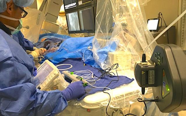 A CSI Diamondabck 360 atheretectomy system in use during a cath lab procedure at Henry Ford Hospital in Detroit. Photo by Dave Fornell