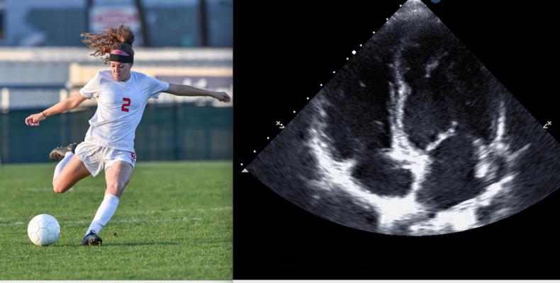 New Multimodality Cardiac Imaging Guidelines for Competitive Athletes Created. ASE SCCT and SCMR recommendations for imaging, screening atheletes.