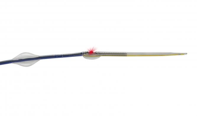 Avinger Receives 510(k) Clearance for Pantheris Image-Guided Atherectomy Device Modifications