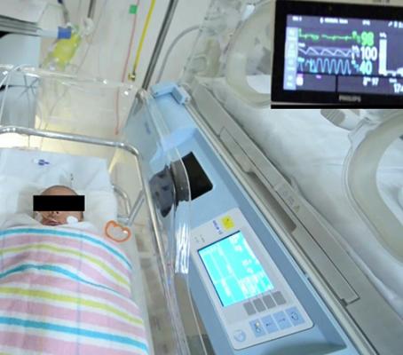A team at the University of South Australia designed a computer vision system that can automatically detect a baby’s face in a hospital bed and remotely monitor its vital signs from a digital camera with the same accuracy as a traditional ECG machine.