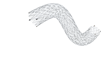 Procedure performed as part of the company’s ongoing CGuardians U.S. Investigational Device Exemption (IDE) trial designed to support potential U.S. marketing approval of the CGuard stent system 