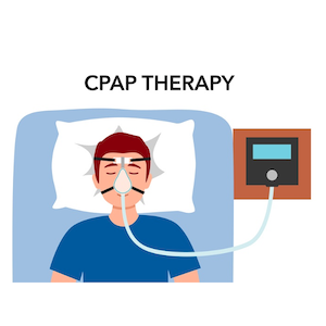 apnea, Sinai, CPAP, sleep disorder