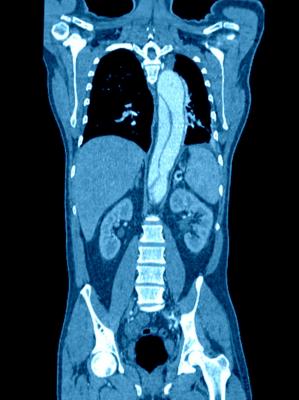 CT, computed tomography, IV contrast media, acute kidney injury risk, Annals of Emergency Medicine study