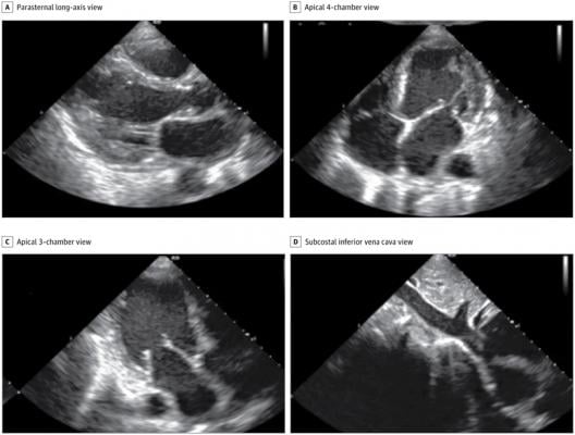Representative still images of 4 of the 10 standard transthoracic echocardiographic views acquired by a nurse using the Caption Health deep-learning algorithm that were judged to be of diagnostic quality. 