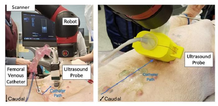 The model automatically pinpoints the location of cardiac catheters in photoacoustic images, paving the way for safer cardiac procedures 