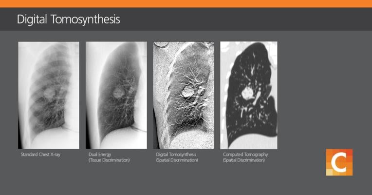 Carestream Health is partnering with Robarts Research to demonstrate the clinical value of digital tomosynthesis and dual energy technologies to help improve patient outcomes. (Graphic: Business Wire) 