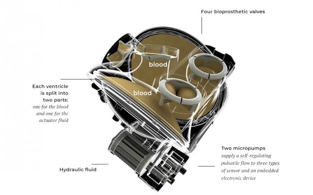 The Carmat system, an experimental artificial heart includes an autoregulation control mechanism, or Auto-Mode, that can adjust to the changing needs of patients treated for end-stage heart failure. Outcomes in the first series of patients managed with the new heart replacement pump in Auto-Mode are presented in the journal of the American Society for Artificial Internal Organs (ASAIO). 