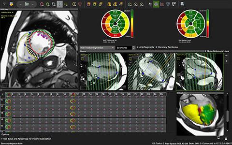 Circle Cardiovascular Imaging and Galgo Medical Enter Distribution and Joint Development Agreement