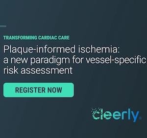 ischemia, plaque, ai