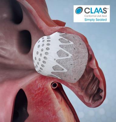 The Conformal Medical CLAAS device, a next-generation transcatheter left atrial appendage (LAA) closure occluder for patients with atrial fibrillation (AF). LAA occlusion allows AFib patients to go off of life-long anticoagulation therapy. #LAA #LAAC