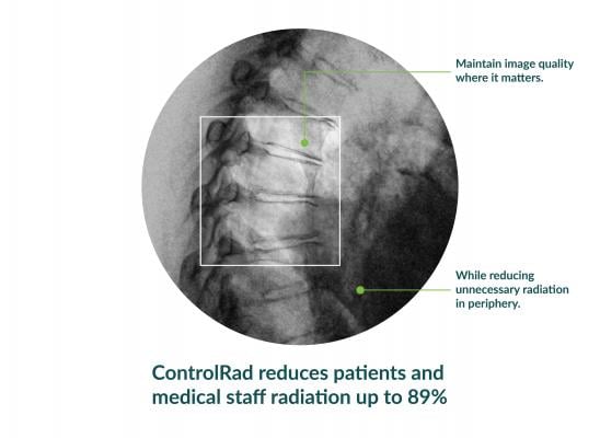 ControlRad Announces FDA Clearance and Launch of ControlRad Trace