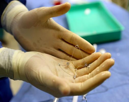Israeli Hospital Completes First Implant of CORolla Heart Failure Device