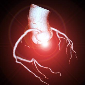 Expert: Faster and Cost-effective CCTA Testing Helps Save Lives