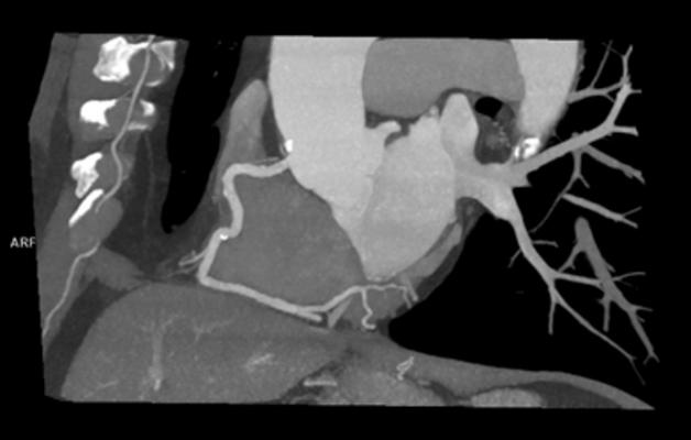 Mednax National Cardiac Centers Of Excellence Program Highlighted At Scct 2019 Daic