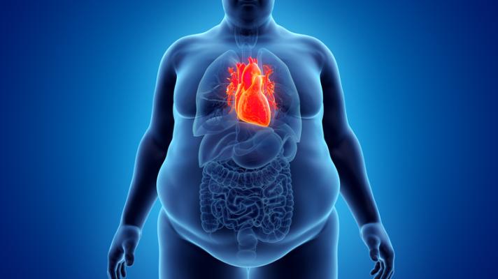 A newly-published study in the European Society of Cardiology’s European Heart Journal is shedding new light on the obesity paradox.