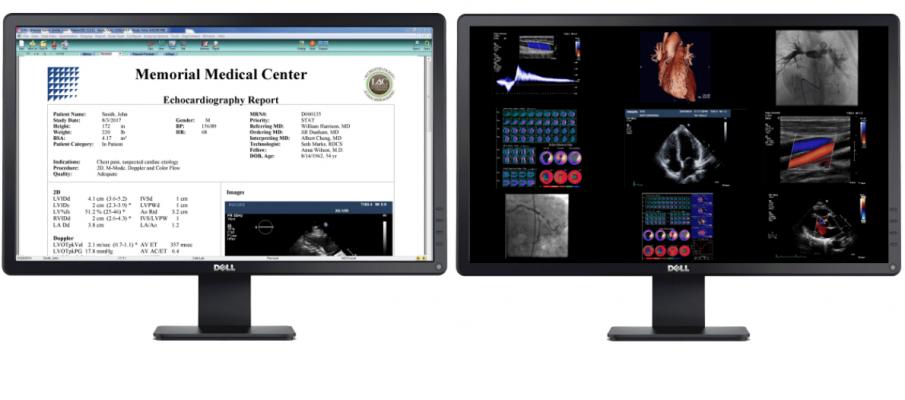 Digisonics cardiovascular information system (CVIS) can be used to aid remote image and report access to reduce in-person staff interaction to aid COVID-19 containment efforts.