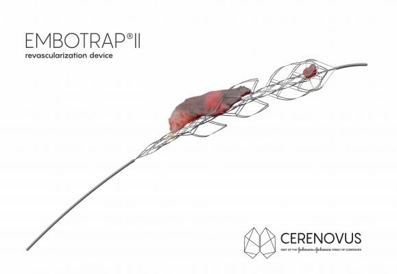 Cerenovus Launches Global Registry for EmboTrap II Revascularization Device