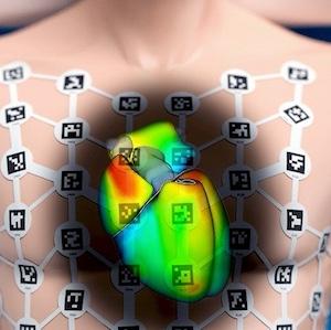 FDA, cardiac mapping, ep lab