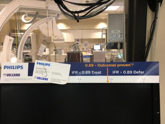 iFR reference numbers posted for new users in the cath lab at Northwestern Medicine's Central DuPage Hospital in Winfield, Ill.