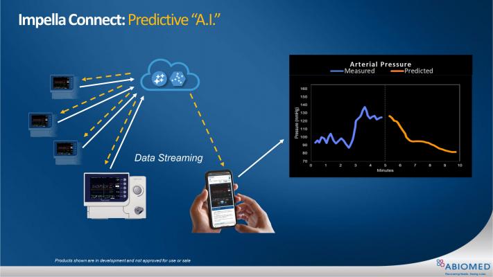 The Abiomed Impella Connect allows data streaming from the Impella control consoles to the cloud, where the next step will be to apply predictive artificial intelligence (AI) algorithms.
