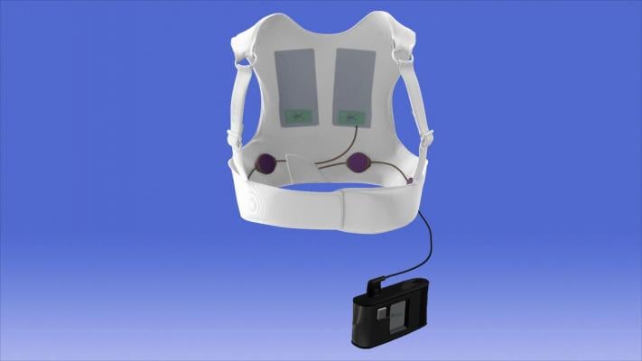 Zoll LifeVest wearable defibrillator, WEARIT-II Registry results, CardioStim EuroPace 2016