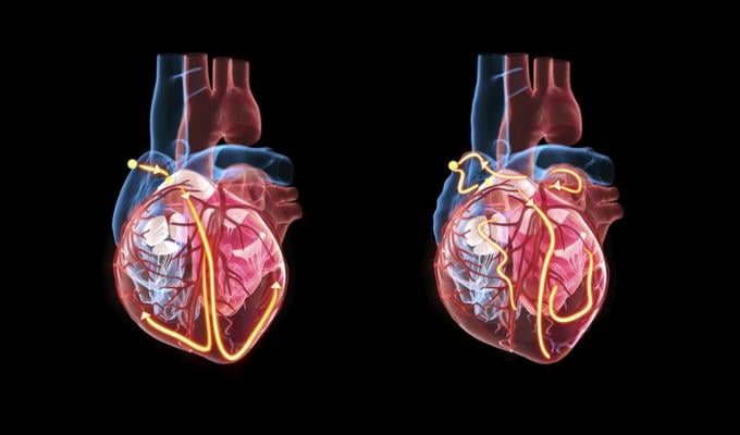 For men and women, the risk factors for cardiovascular disease are largely the same, an extensive global study involving University of Gothenburg researchers shows. 